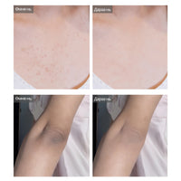 Dr.Melaxin Peel Shot Exfoliating Kojic Acid Turmeric Spray