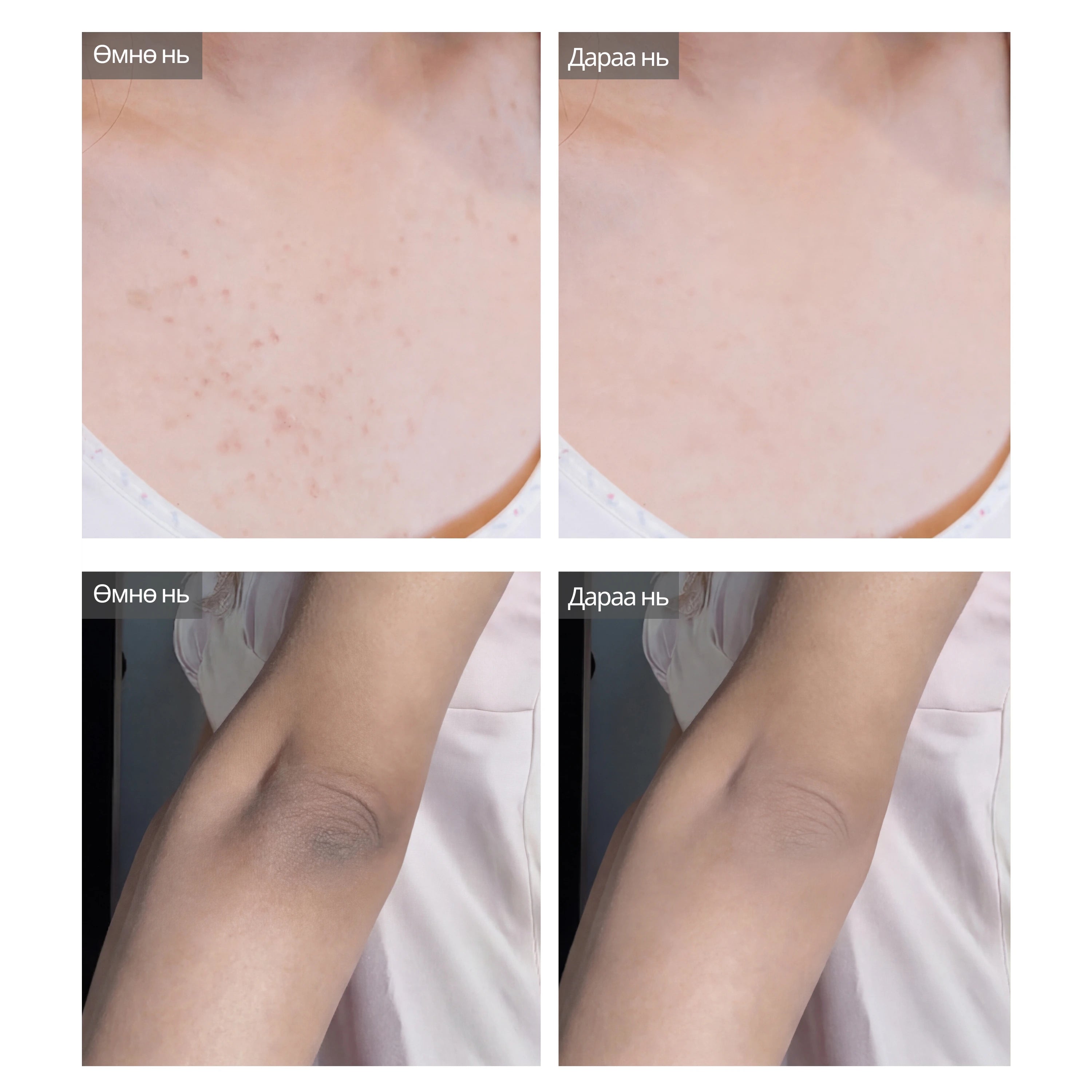 Dr.Melaxin Peel Shot Exfoliating Kojic Acid Turmeric Spray