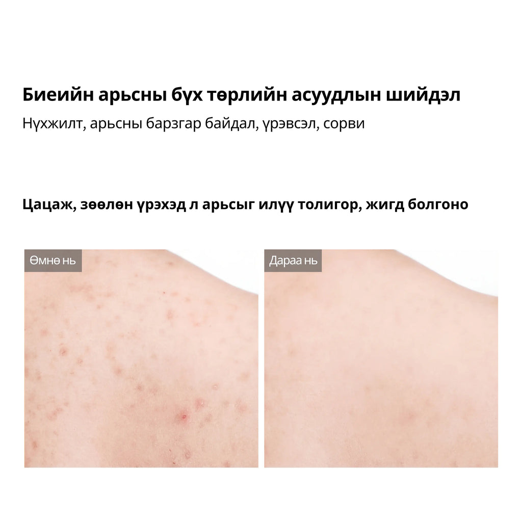 Dr.Melaxin Peel Shot Exfoliating Kojic Acid Turmeric Spray