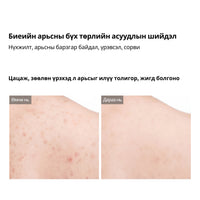 Dr.Melaxin Peel Shot Exfoliating Kojic Acid Turmeric Spray