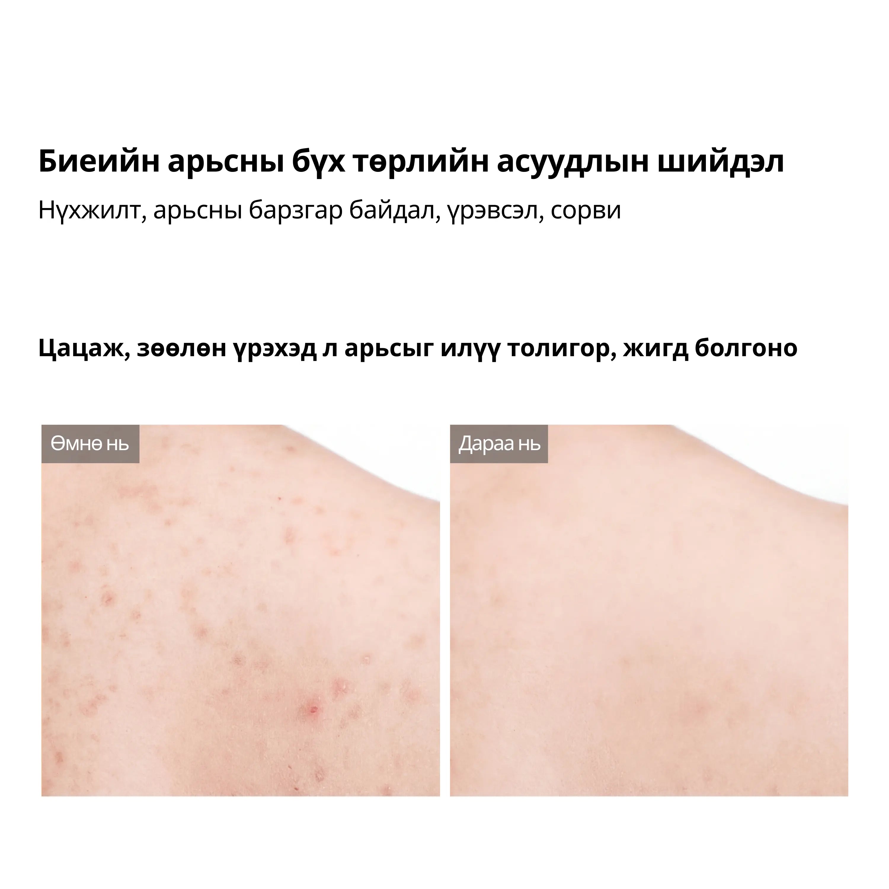 Dr.Melaxin Peel Shot Exfoliating Kojic Acid Turmeric Spray